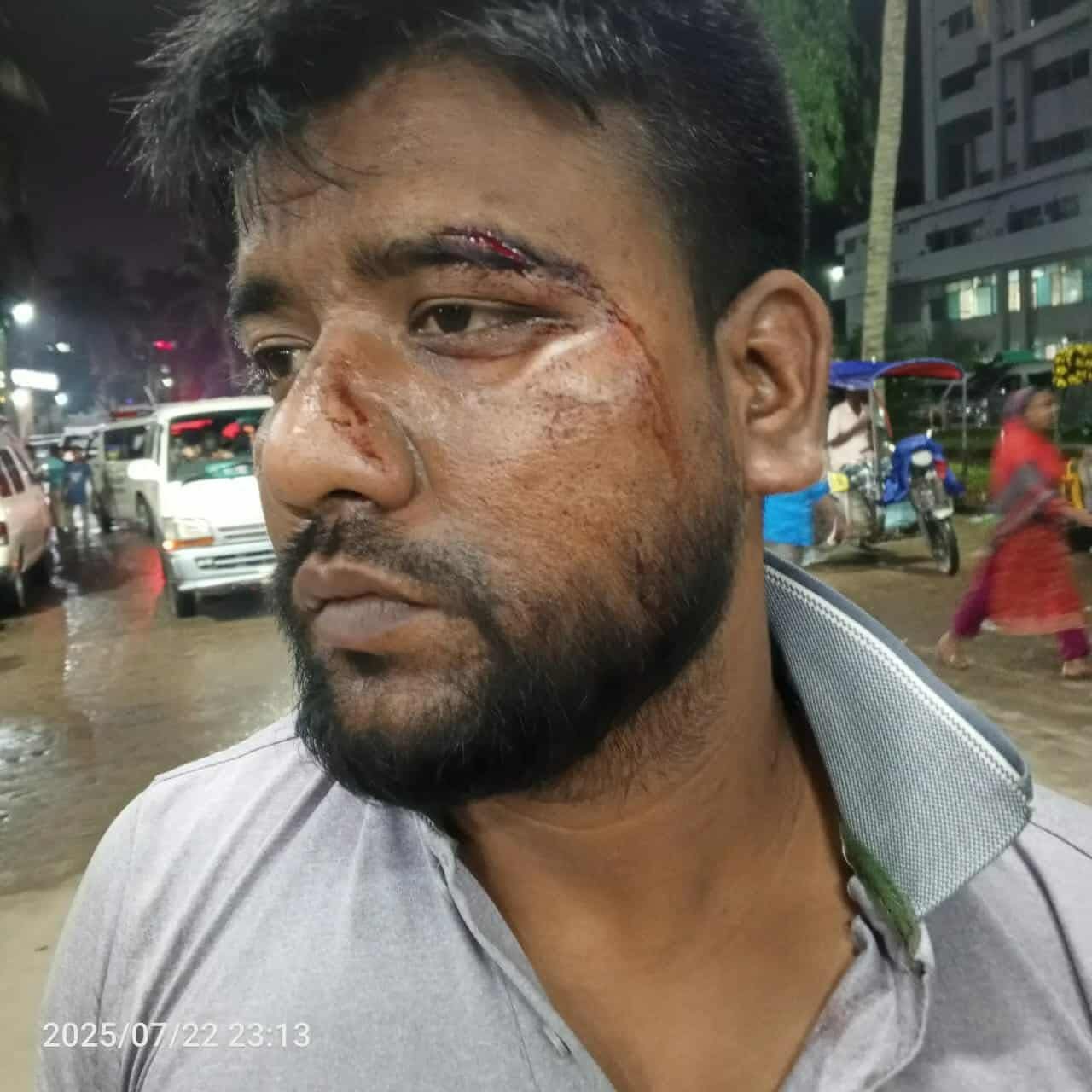নান্দাইলে পূর্ব শত্রুতার জেরে কুপিয়ে জখম, নগদ অর্থ ও চেইন লুট। 