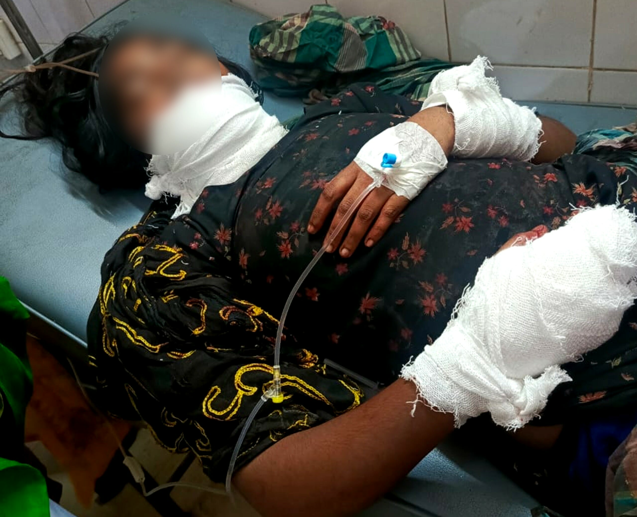 ঈশ্বরগঞ্জে বিয়ের প্রস্তাব প্রত্যাখ্যান করায় কিশোরীকে কুপিয়ে জখম, গ্রেফতার ৩