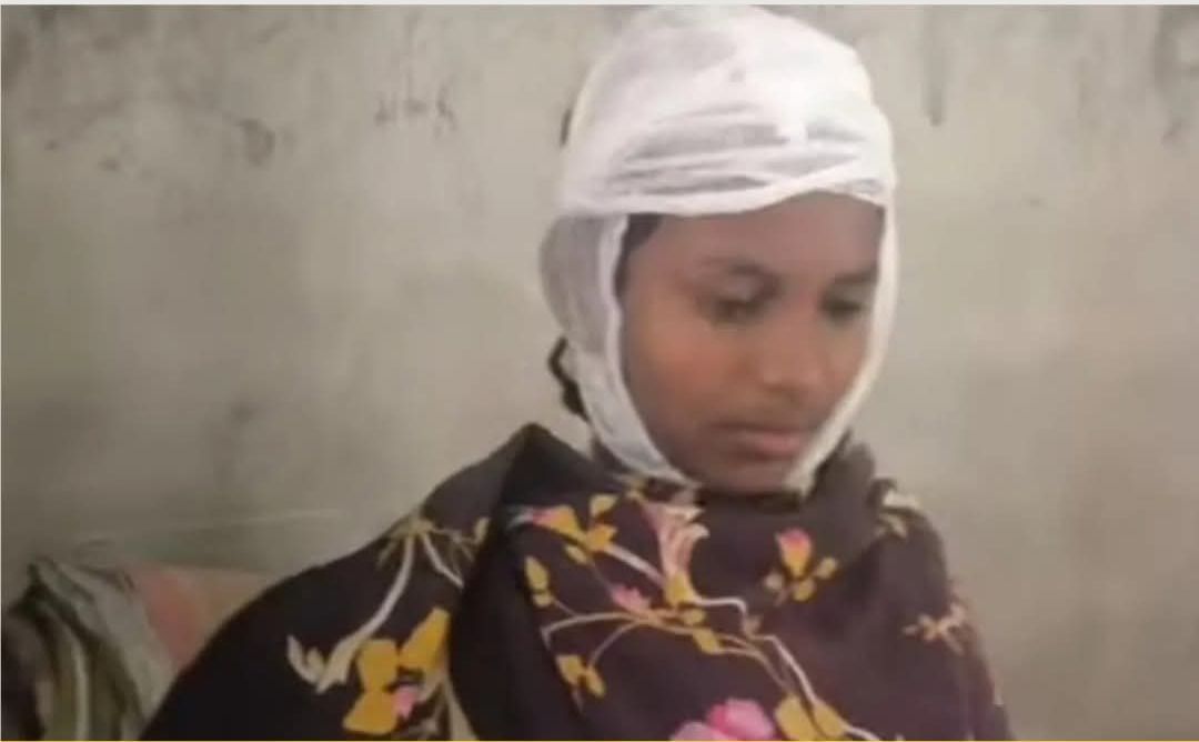 ডাস্টার দিয়ে পিটিয়ে ছাত্রীকে রক্তাক্ত করলেন প্রধান শিক্ষক 