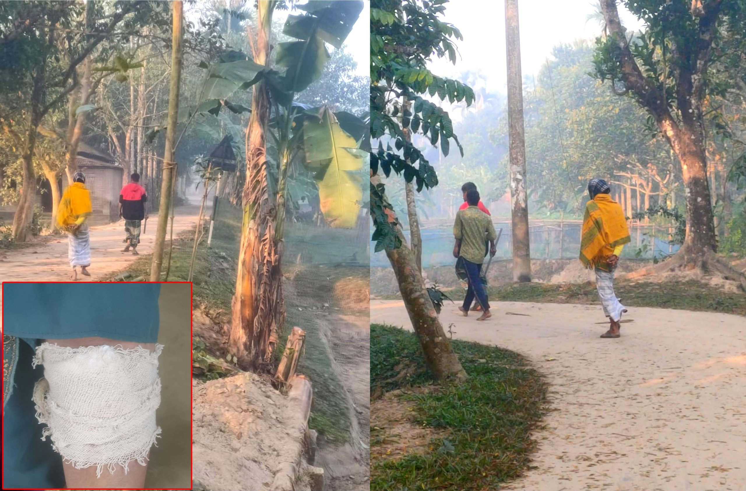 ঈশ্বরগঞ্জে বাড়িতে ঢুকে কিশোরী ও তরুণীকে কুপিয়ে জখম