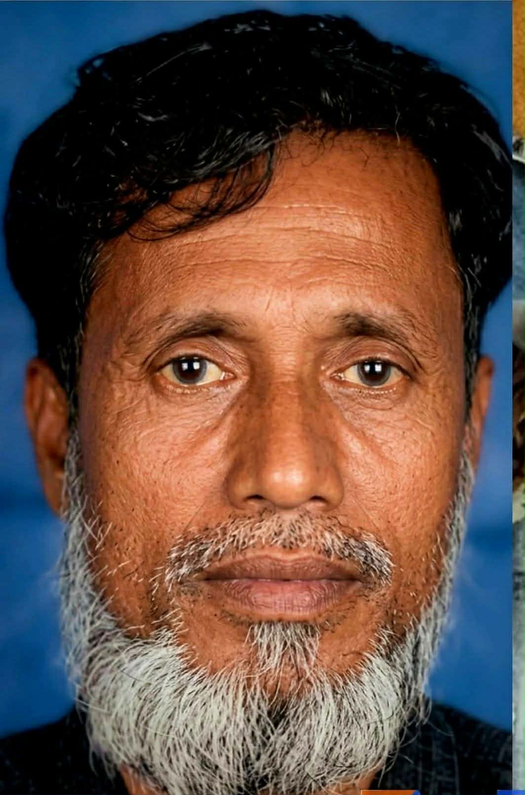 নবীগঞ্জের ছোট ভাকৈর গ্রামে বজ্রপাতে ৩ জন আহত ১ জনের মৃত্যু। 