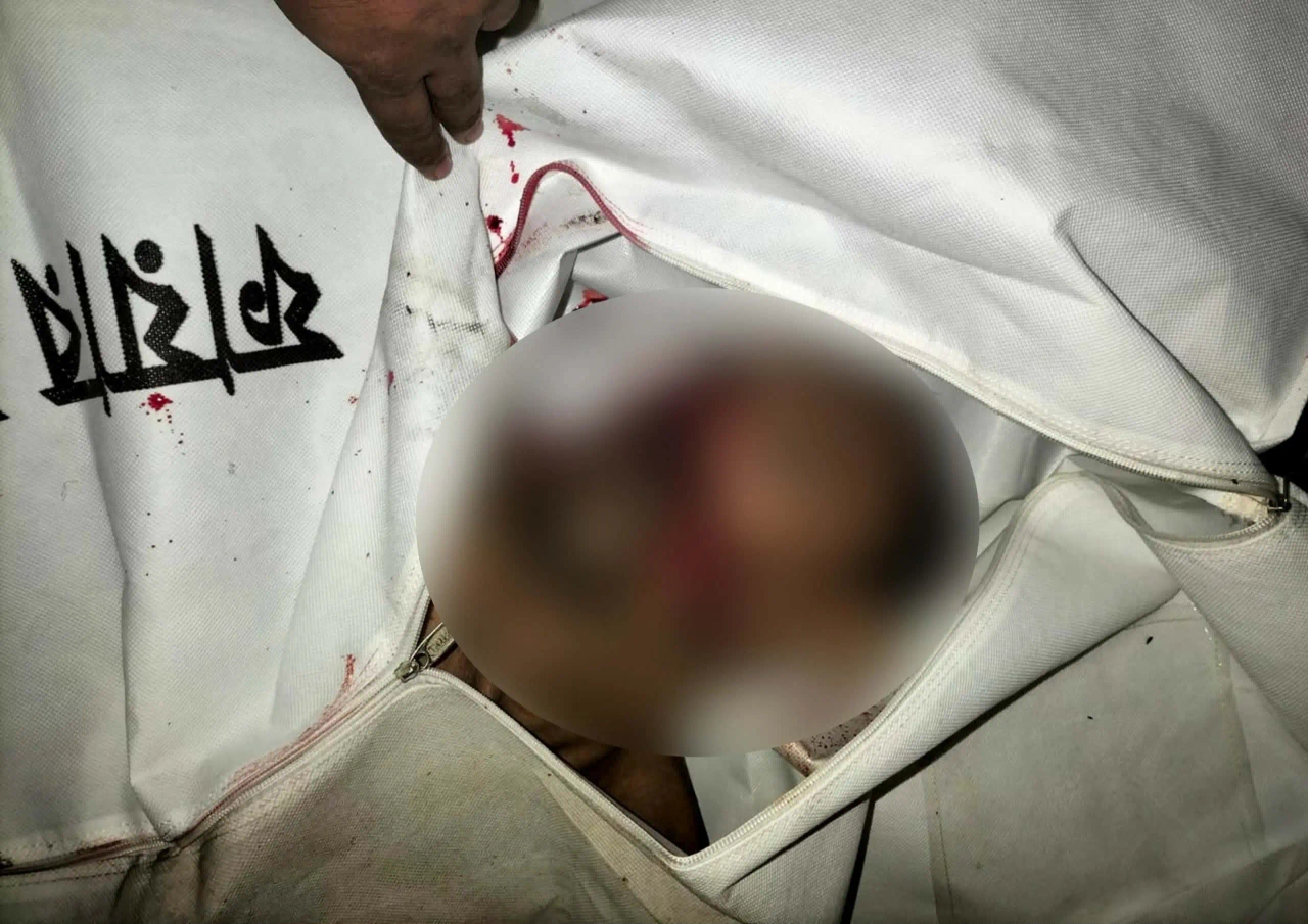 ঈশ্বরগঞ্জে অটোরিকশার ধাক্কায় শ্রমিক নি*হ*ত, চালকসহ অটোরিকশা আটক